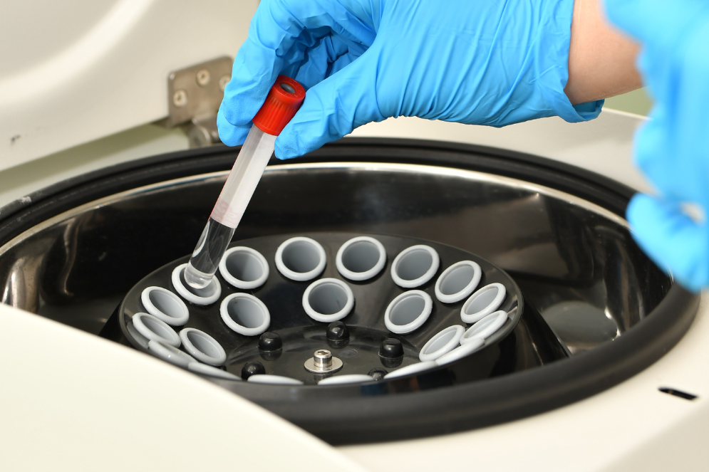 Control de temperatura y humedad en incubadora de laboratorio clínico